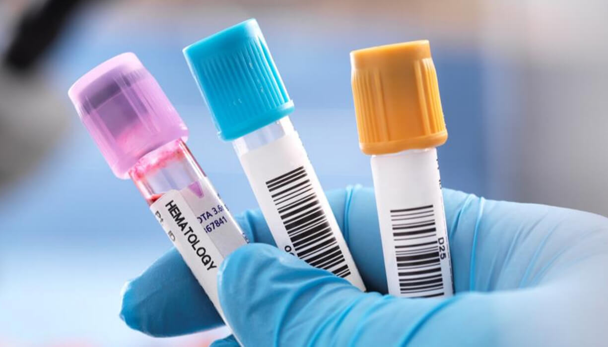 Boosting Investment in Local Manufacturing of IVD Kits